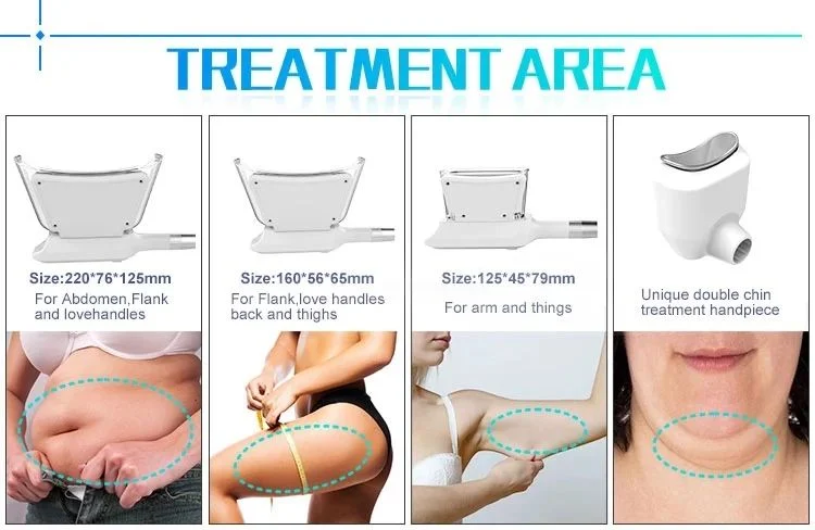 Cryolipolysis (fat freezing) for belly fat - ICE AESTHETIC