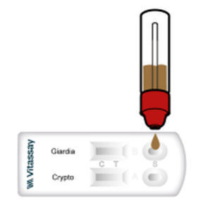 Cryptosporidiosis: Treatment and prevention - UpToDate